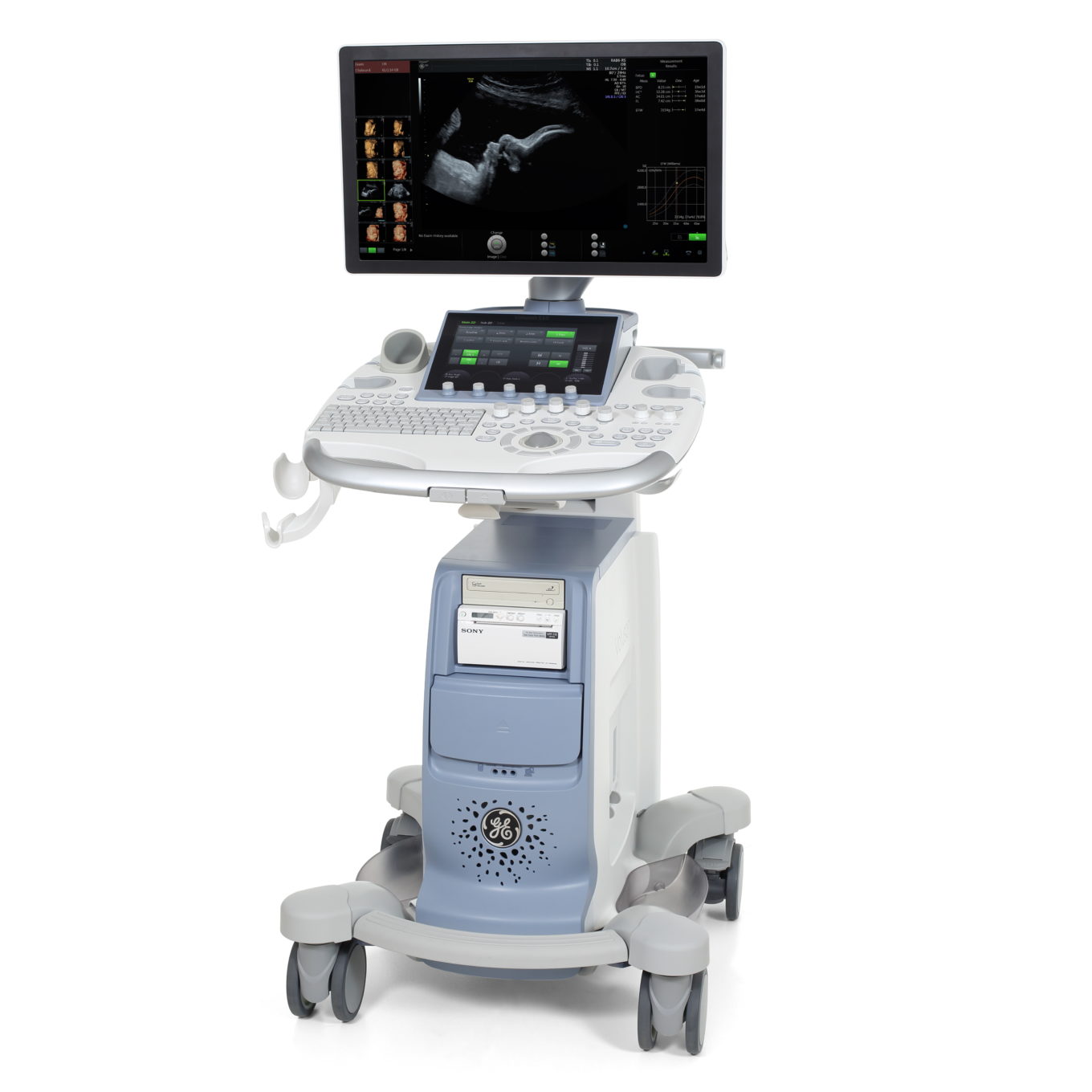 GE VOLUSON S10