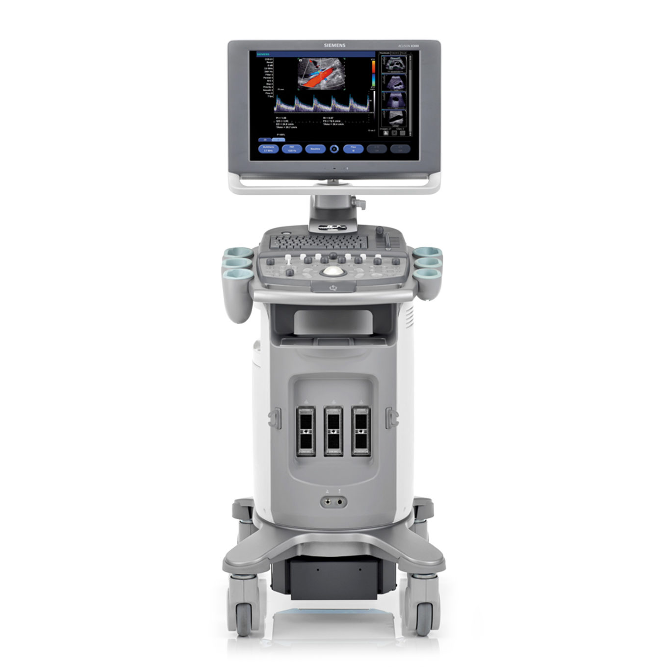 Siemens ACUSON X300 Premium Edition