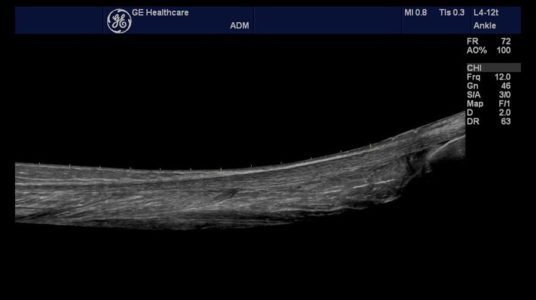 Ankle, датчик L4-12t
