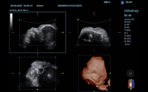 Fetal Face, датчик D6-2P