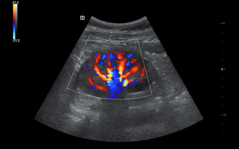 Kidney
