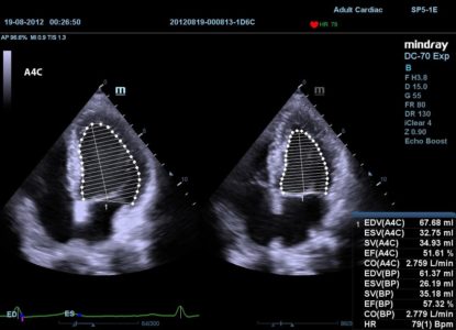 Adult Cardiac, датчик SP5-1E