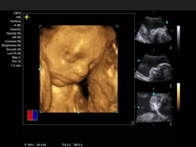 Fetal Face, датчик C8F3