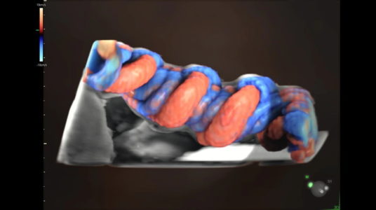 HDlive Flow with umbilical cord